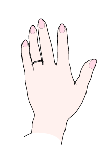 CXg